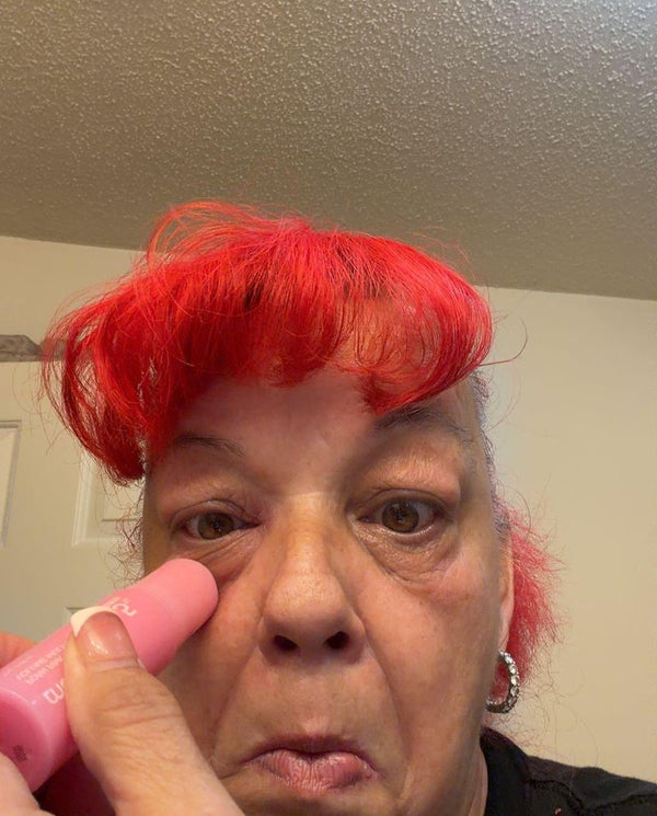 Customer photo from a PDRN balm review