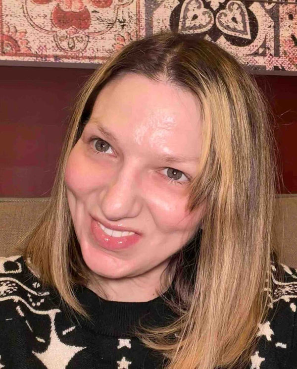 Customer photo from a PDRN balm review