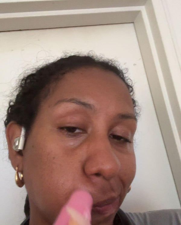 Customer photo from a PDRN balm review