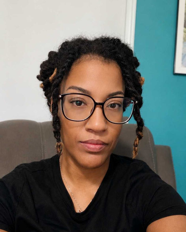 Customer photo from a PDRN balm review
