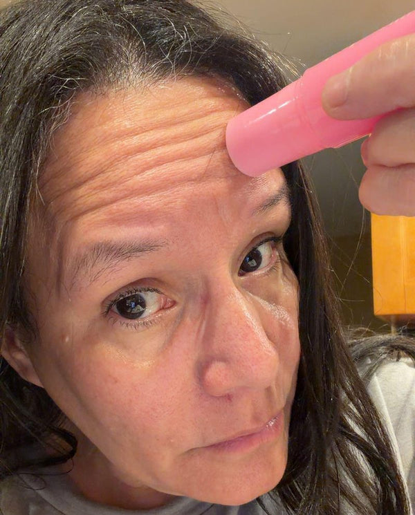 Customer photo from a PDRN balm review
