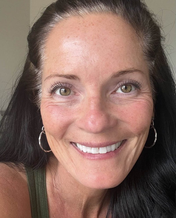 Customer photo from a PDRN balm review
