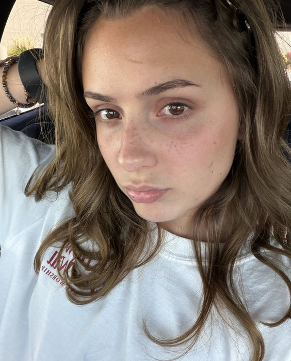 Customer photo from a PDRN balm review